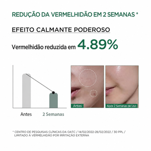 Sérum Calmante Anua Heartleaf 80% | Pele Sensível