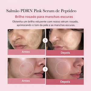 Medicube Ampola Facial Rosa com PDRN de Salmão 30ml