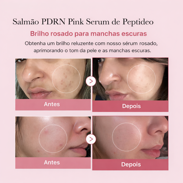 Medicube Ampola Facial Rosa com PDRN de Salmão 30ml