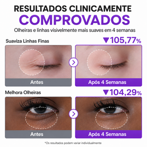 Creme Para Olheiras com Retinol e Niacinamida 4% Numbuzin | NAD+ Peptídeos